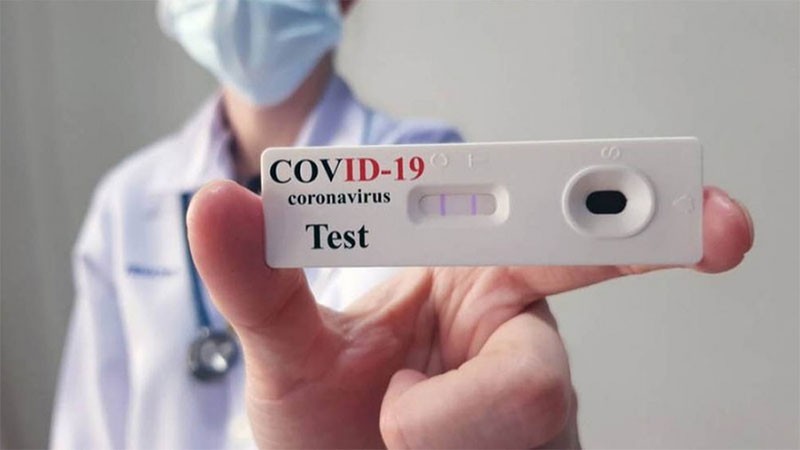 Anmat autorizó el uso de un quinto test de autoevaluación de coronavirus