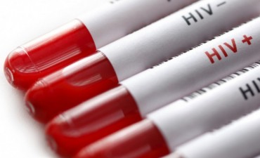 Tierra del Fuego producirá un medicamento contra el HIV desde mediados de este año
